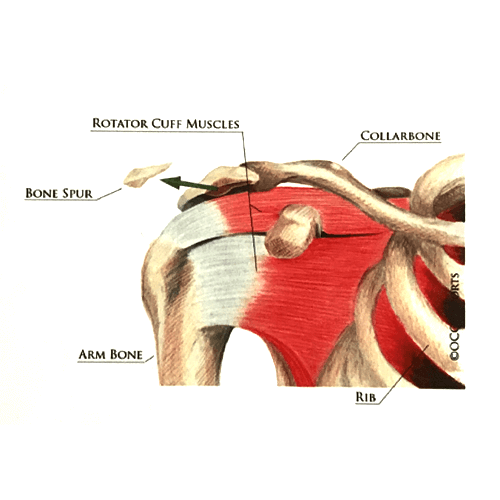 Shoulder Illustration for Medical